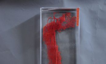 上肢动脉(不带骨)