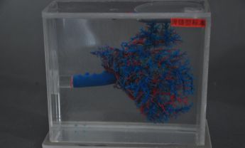 脾淋巴系统铸型标本