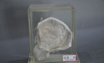 膀胱三角标本